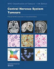 Central Nervous System Tumours: WHO Classification of Tumours 5th Edition by WHO Classification of Tumours Editorial Board | Paperback